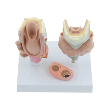 Patoloģiskās Anatomijas Vairogdziedzera Modelis Laryngeal Modelis